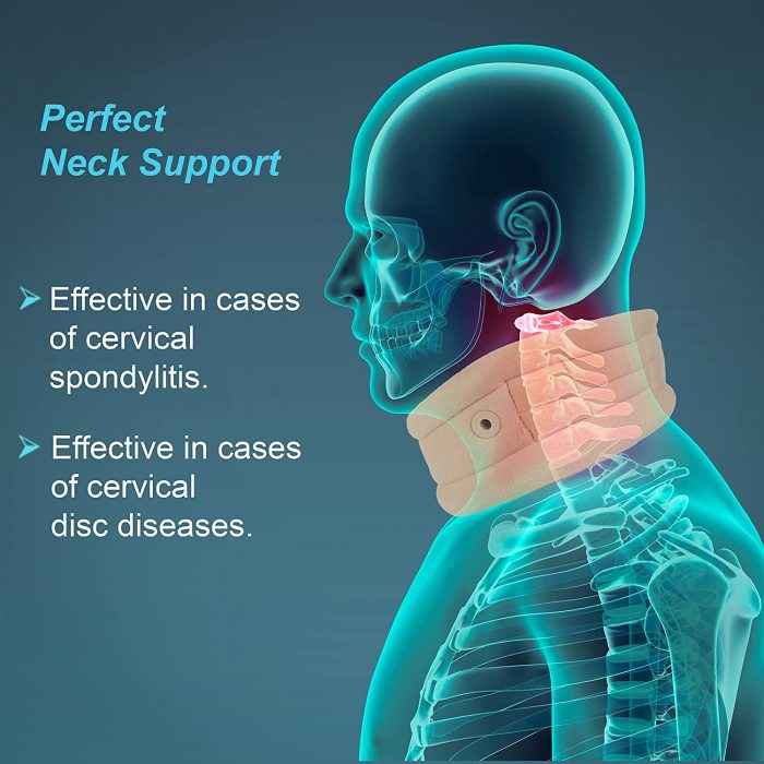TYNOR B-02 CERVICAL COLLAR SOFT WITH SUPPORT, BEIGE, 1 UNIT