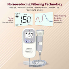 EASYCARE EC2016 Fetal Doppler Machine with High sensitivity Probe
